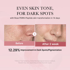 PDRN Pink Peptide Toner - Medicube Bargain