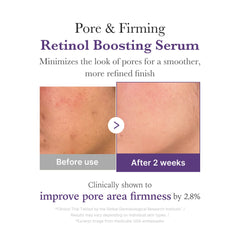 Retinol NMN Boosting Serum - Medicube Discounted