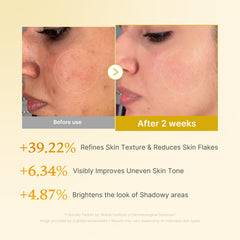 Kojic Acid Turmeric Toner - Medicube Outlets