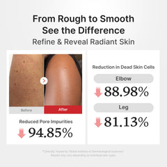 Hypochlorous Acid Rice Body Peel Shot - Medicube Hot Deal