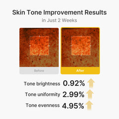 Kojic Acid Turmeric Vita Capsule Cream - Medicube Limited Offer