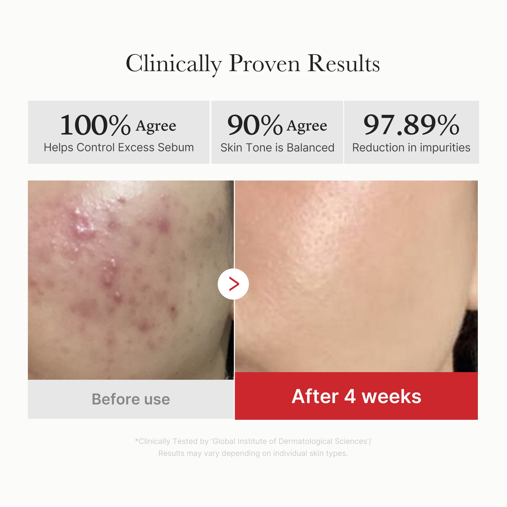 Red Succinic Acid Panthenol Pads - Medicube Value Deal