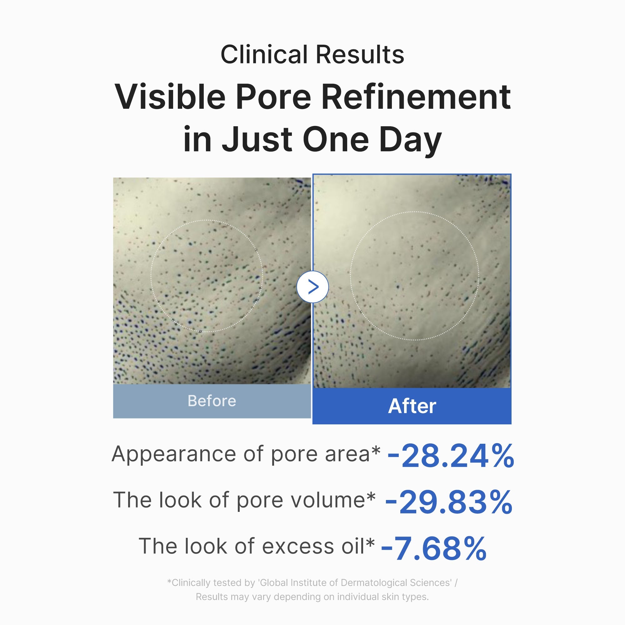 [Subscr.] Zero Pore One-day Peptide Serum - Medicube On Sale