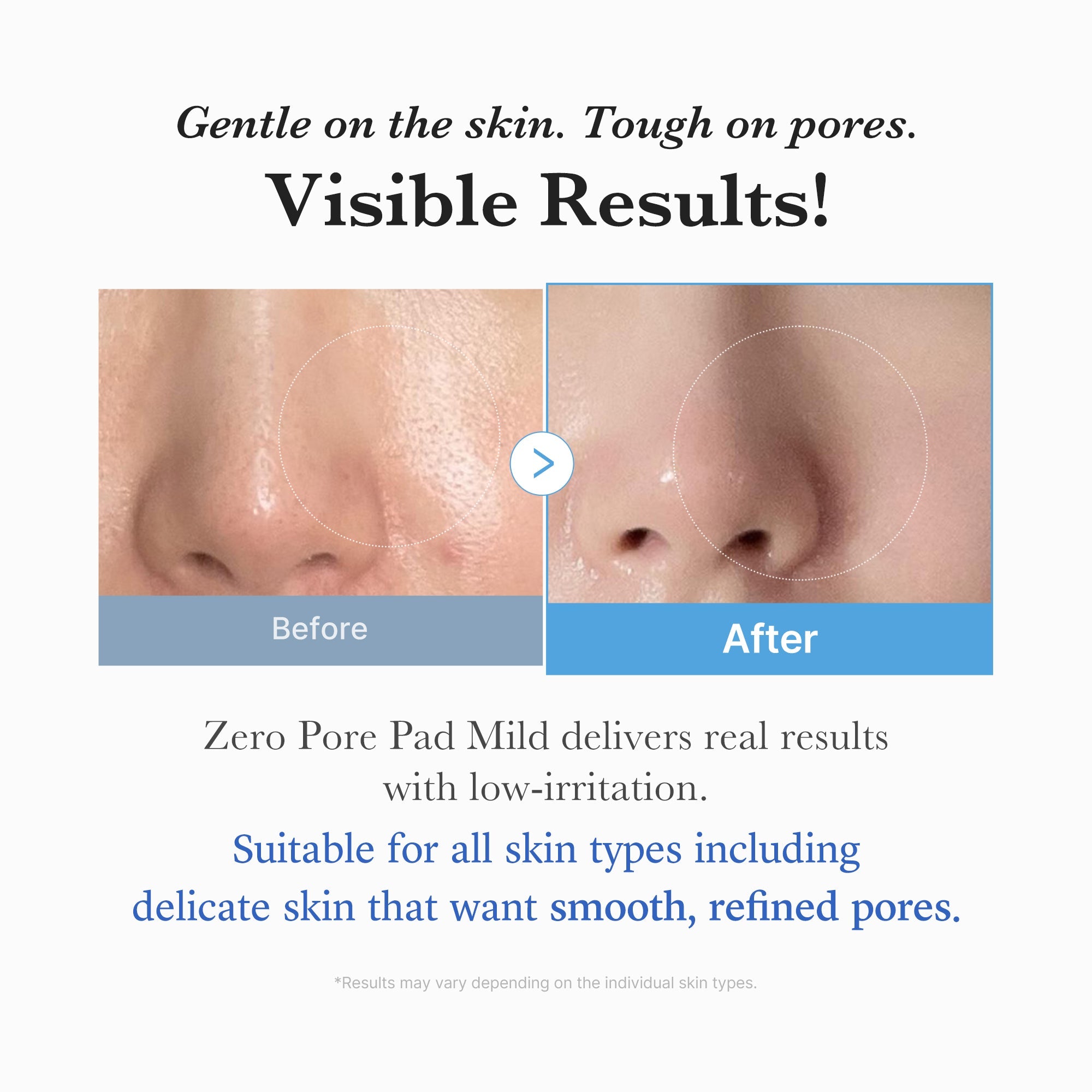 Zero Pore Madecassoside Pads (Mild) - Medicube Sale