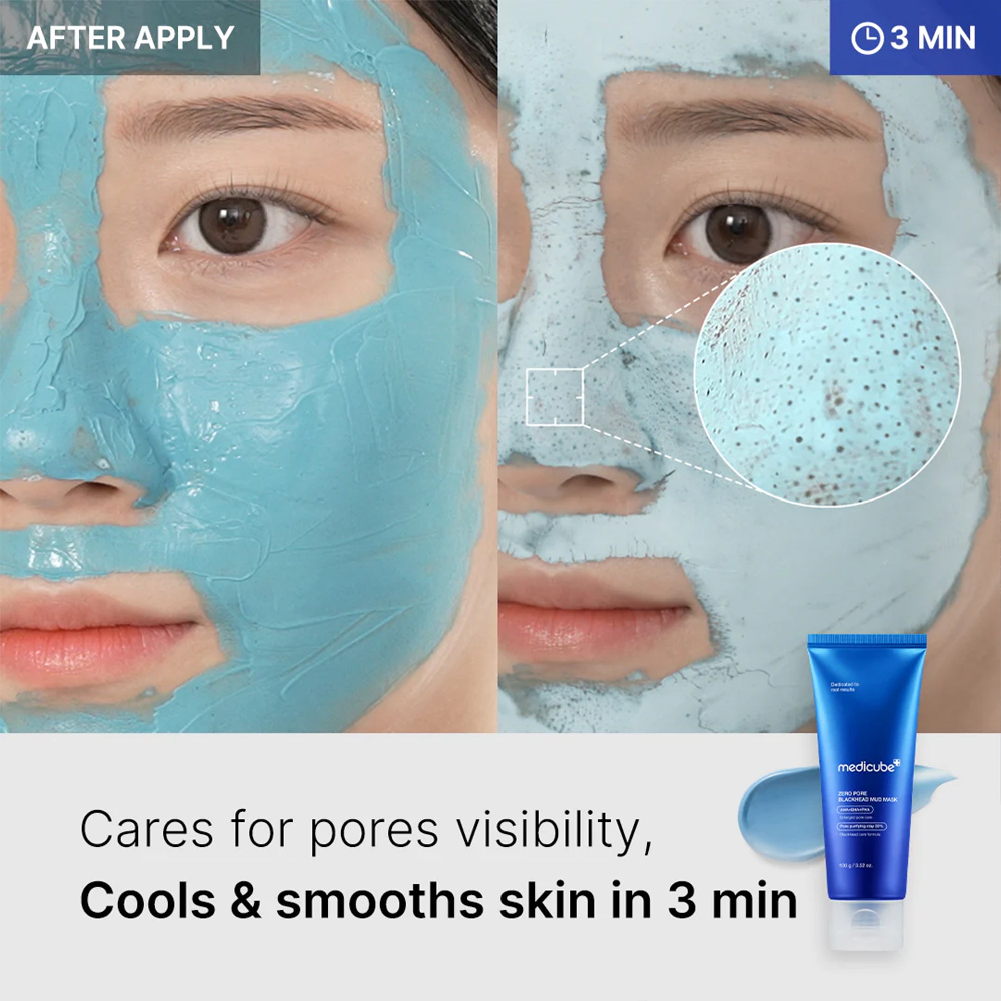 Zero Pore Blackhead Mud Mask - Medicube Hot Deal