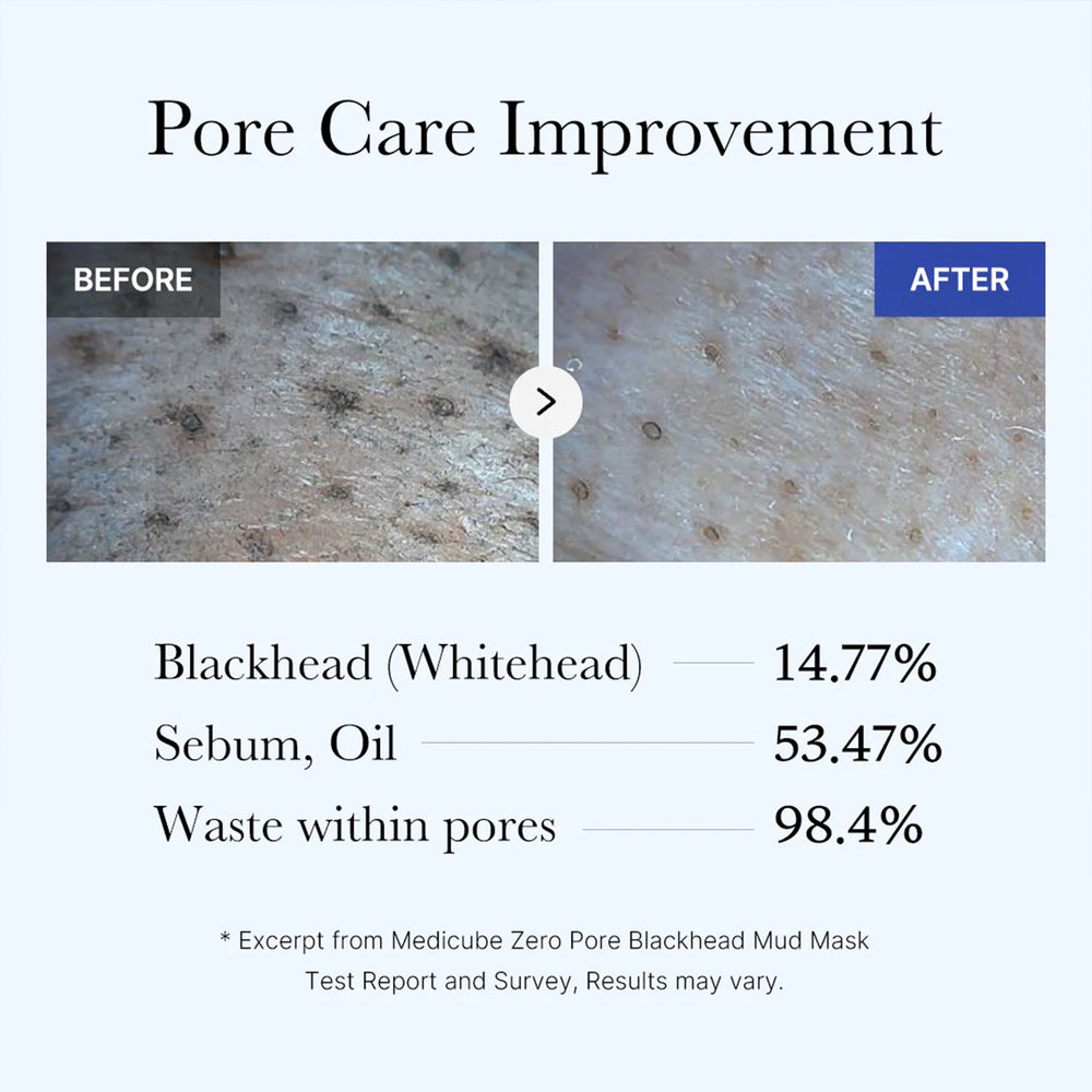 Zero Pore Blackhead Mud Mask - Medicube Hot Deal