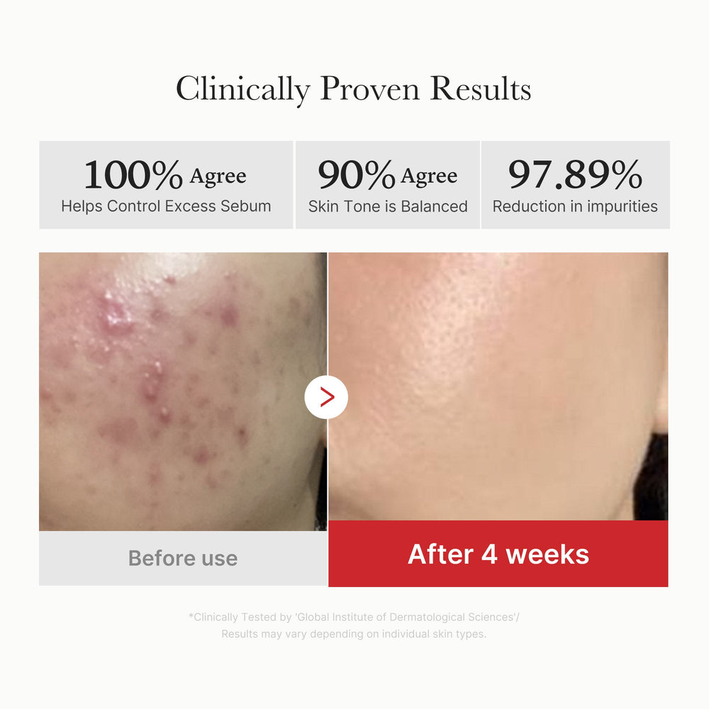 [Subscr.] Red Succinic Acid Panthenol Pads - Medicube Outlets