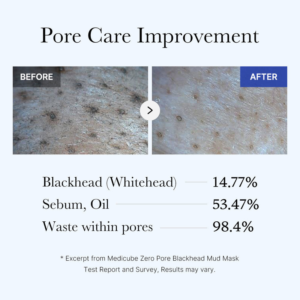 [Subscr.] Zero Pore Blackhead Mud Mask - Medicube Special Offer