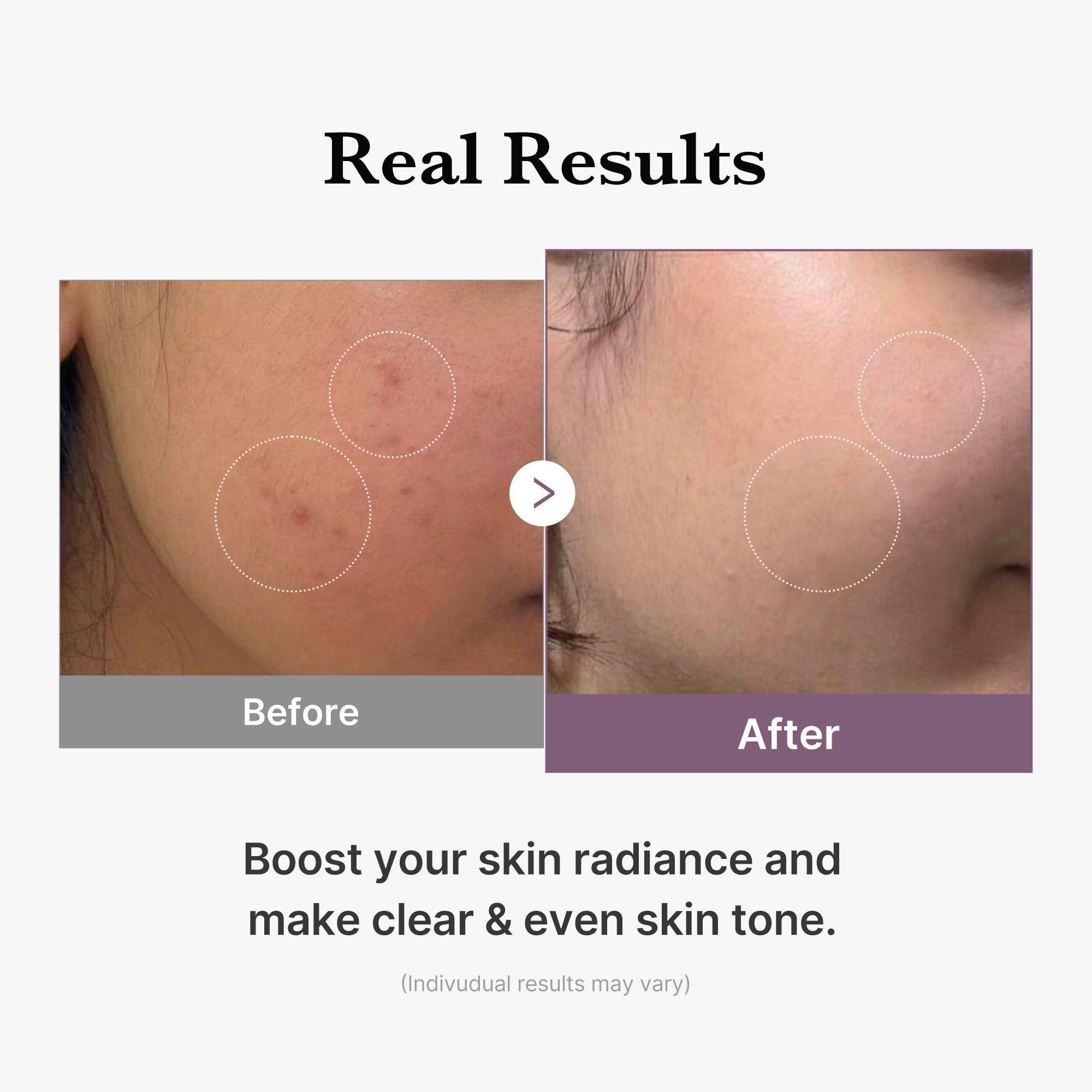AGE-R Glutathione Glow Milk Toner - Medicube Hot Deal