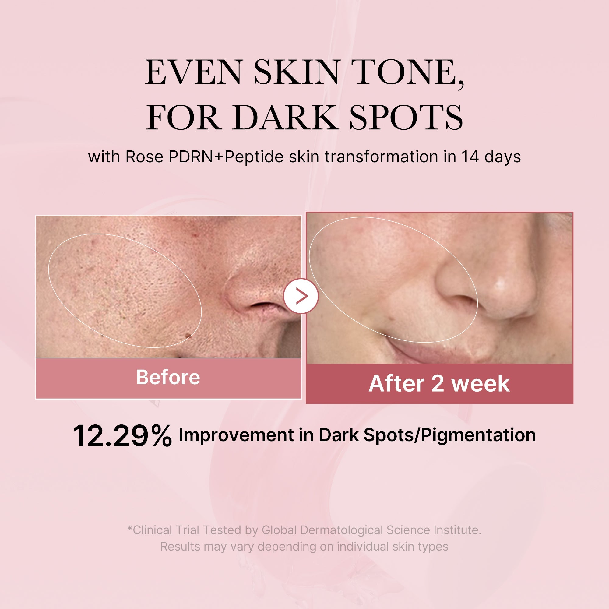 PDRN Pink Peptide Toner - Medicube Bargain