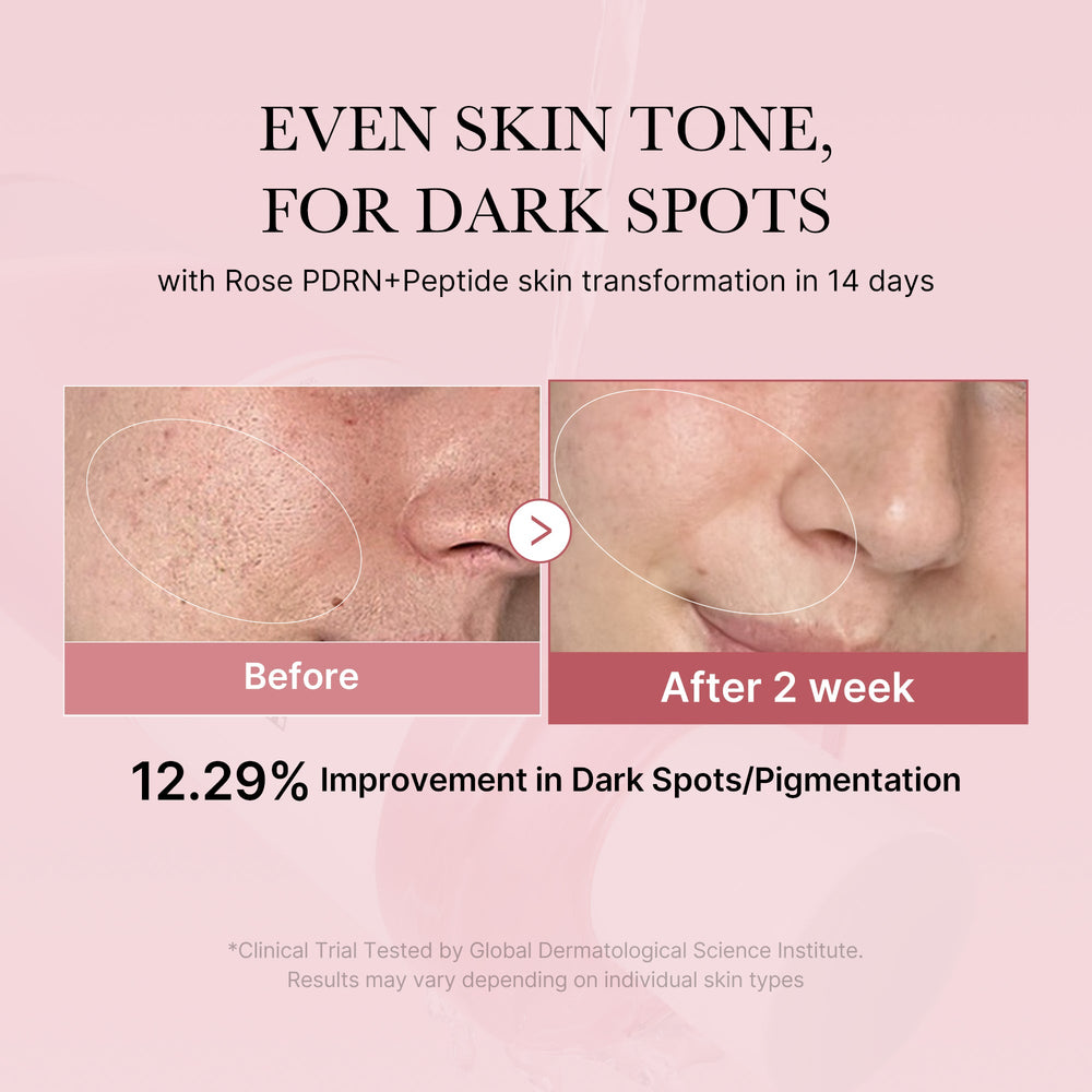 PDRN Pink Peptide Toner - Medicube Bargain