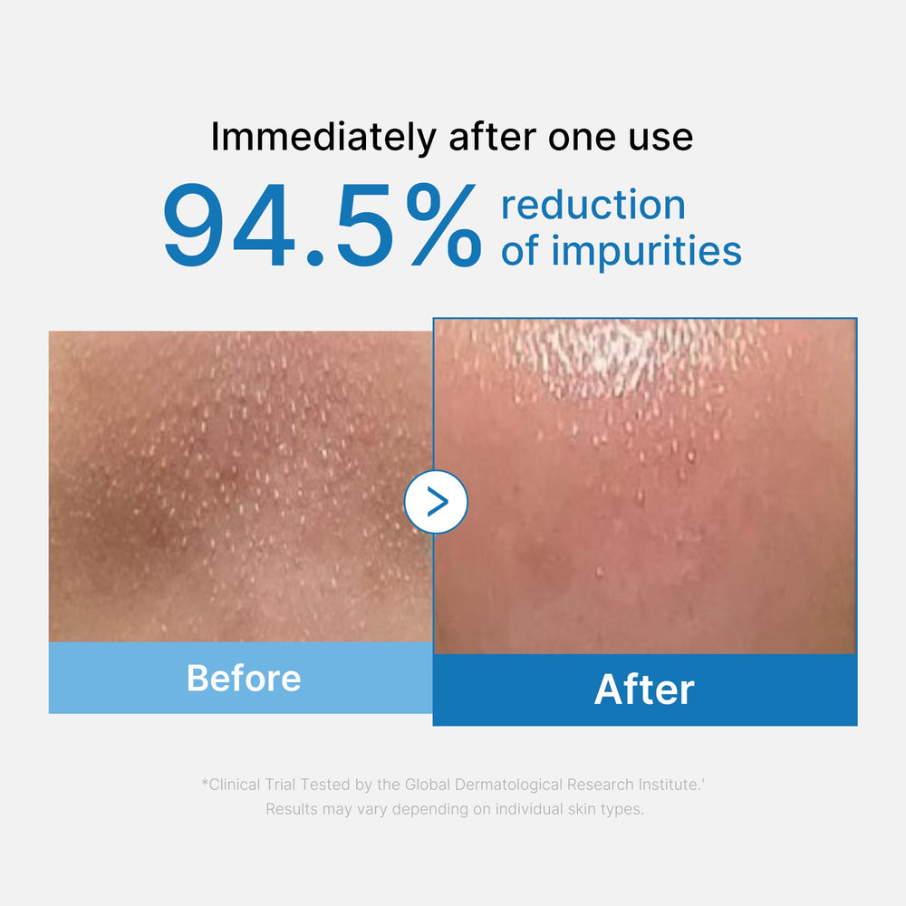 Zero Pore Blackhead Deep Cleansing Oil - Medicube Outlets