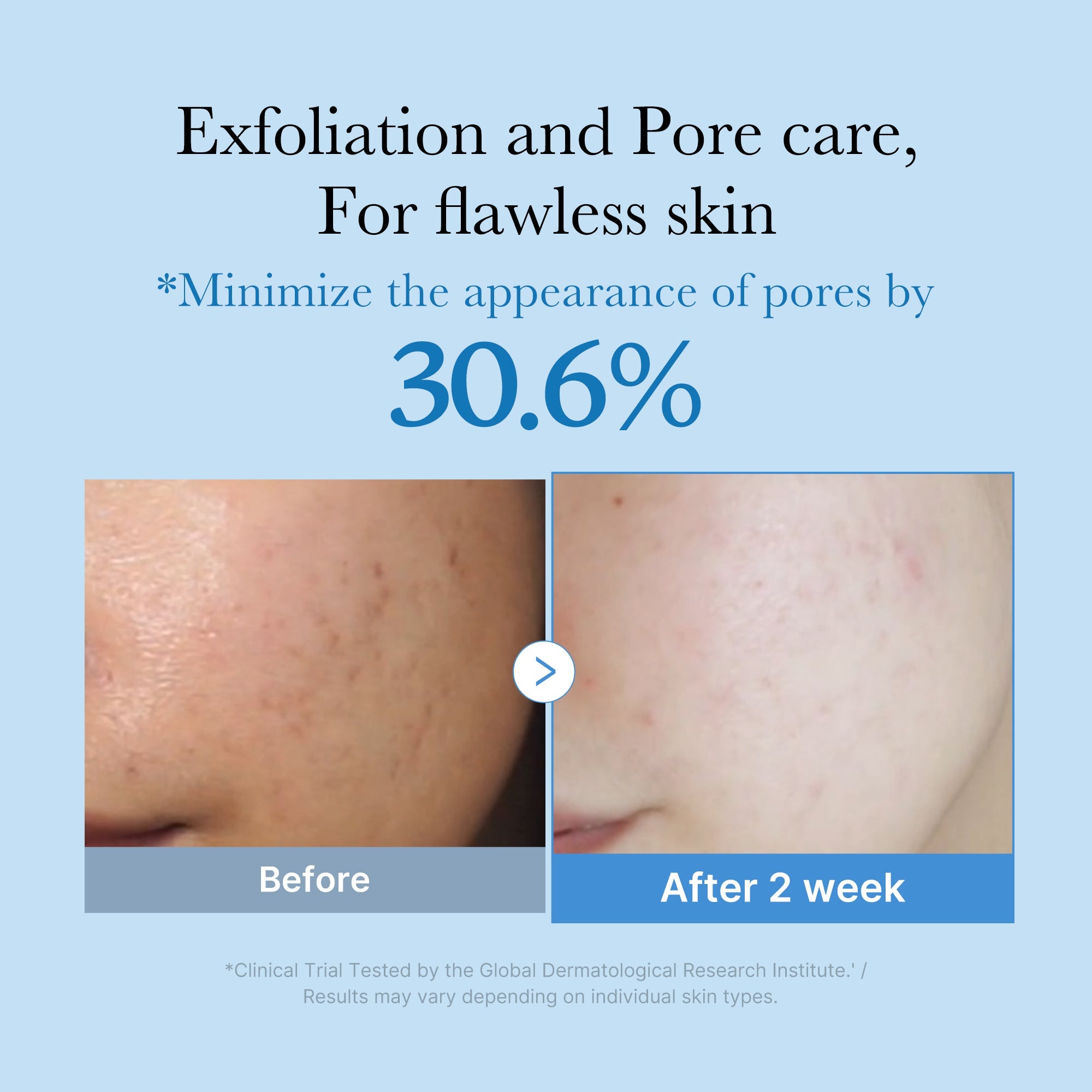 Zero Pore Toner - Medicube Discounted