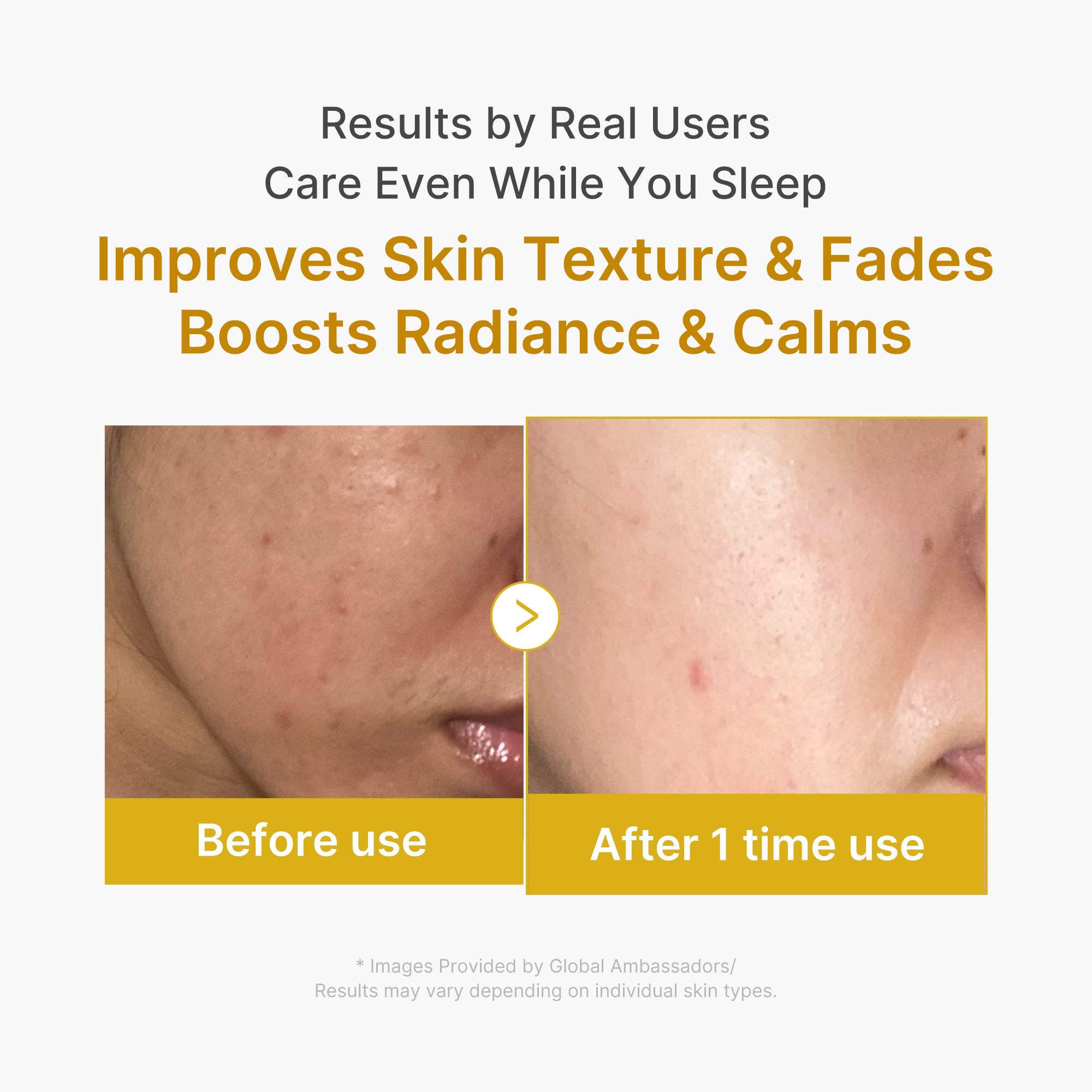 Kojic Acid Turmeric Overnight Wrapping Mask - Medicube Special Offer