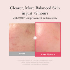 TXA Niacinamide Serum - Medicube Limited Offer