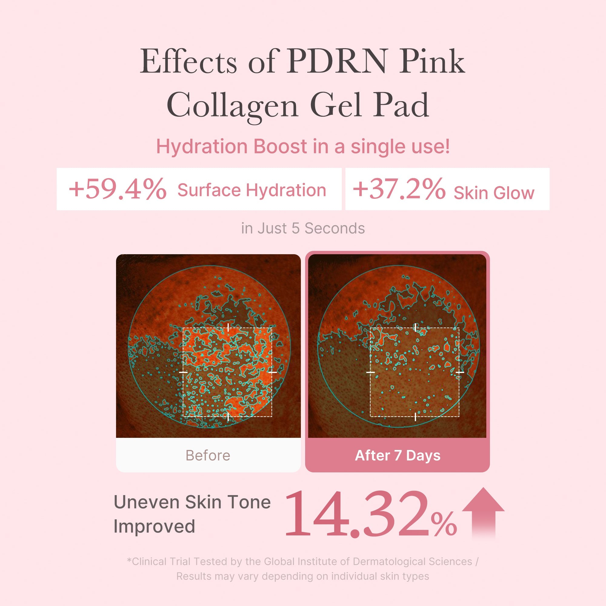 PDRN Pink Collagen Gel Toner Pad - Medicube Savings