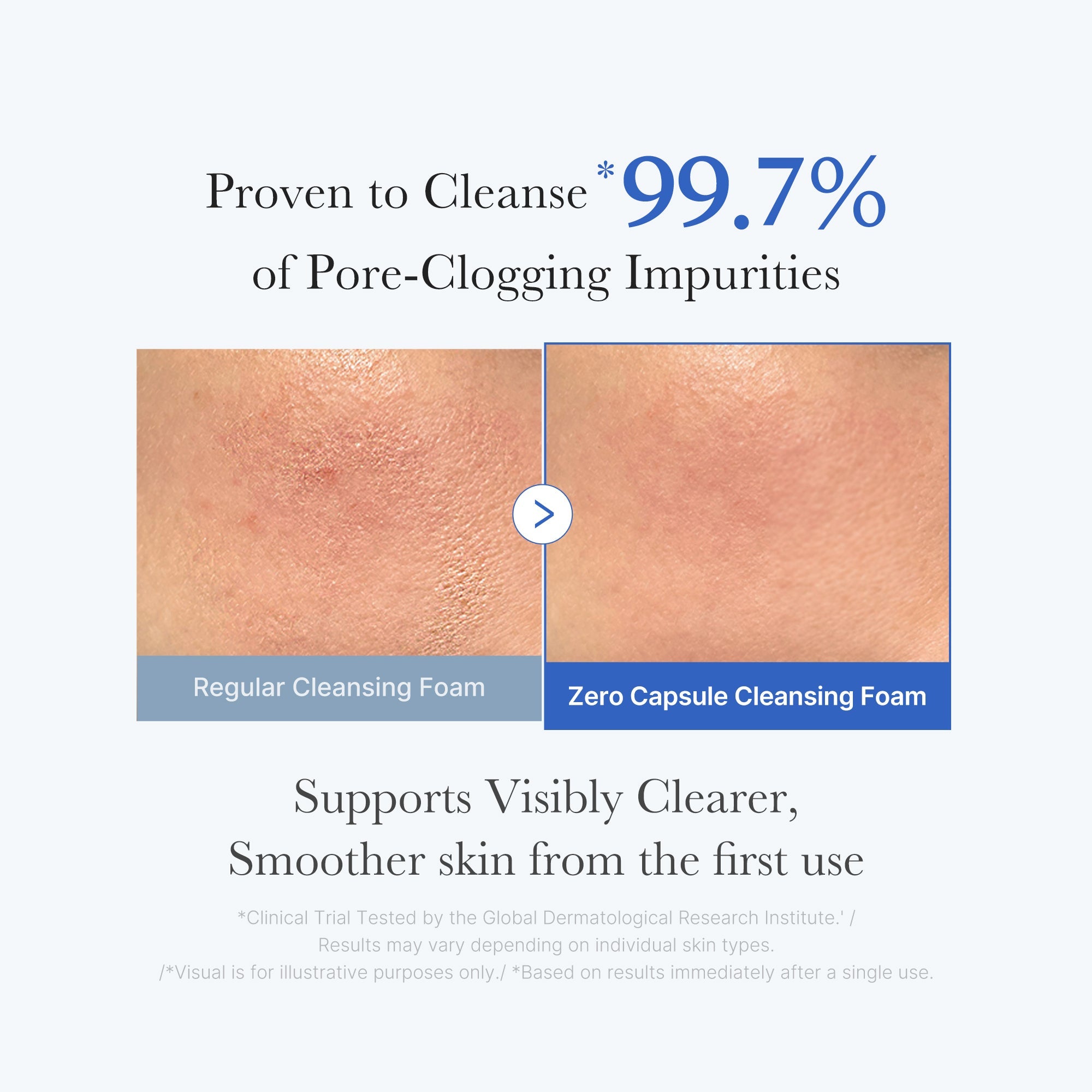 Zero Pore Capsule Cleansing Foam - Medicube Savings