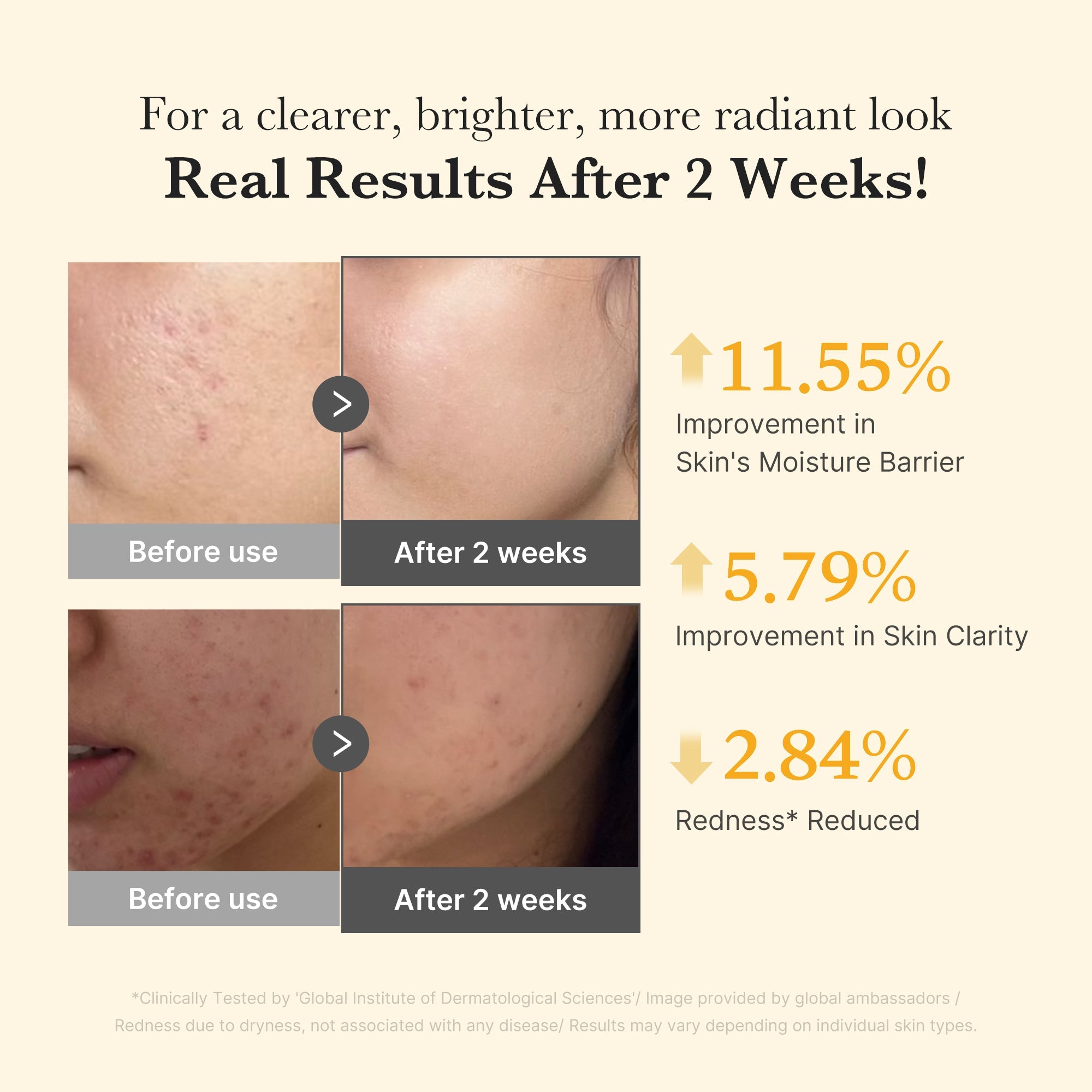 Kojic Acid Turmeric Capsule Serum - Medicube Bargain