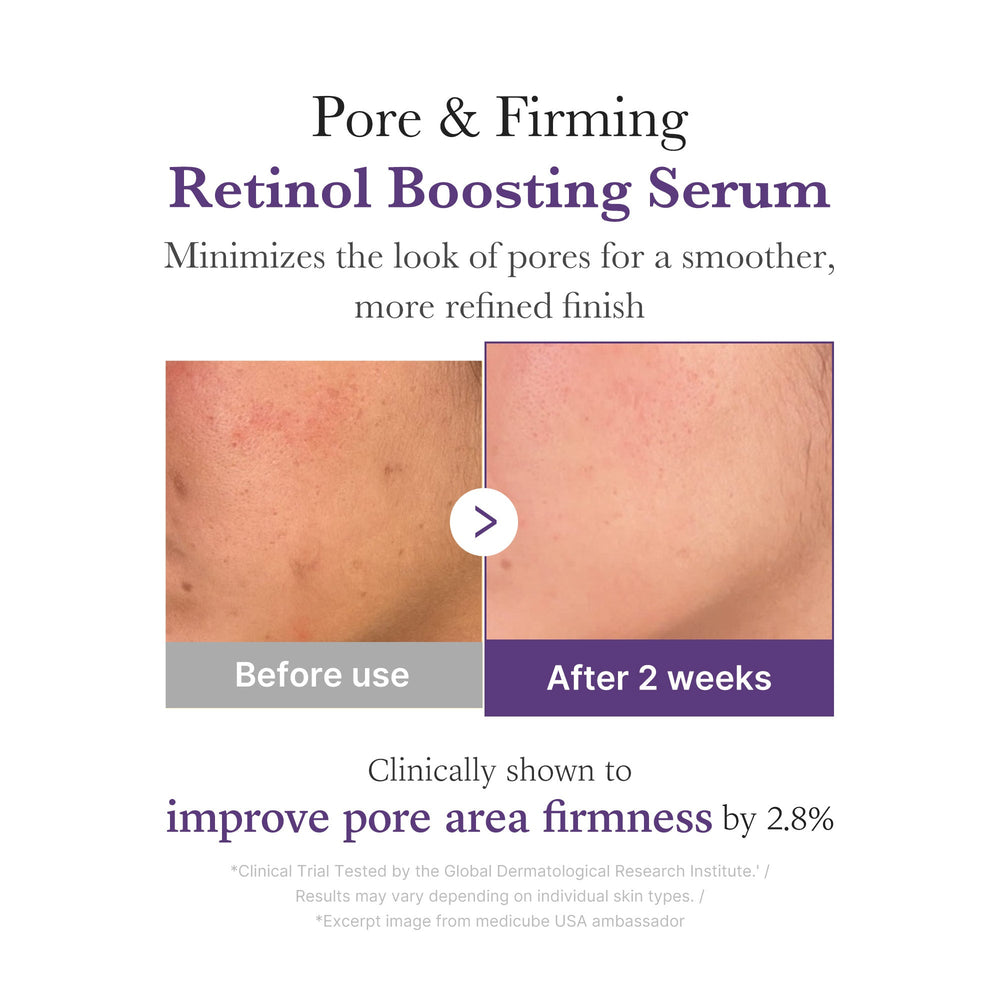 [Subscr.] Retinol NMN Boosting Serum - Medicube Outlets