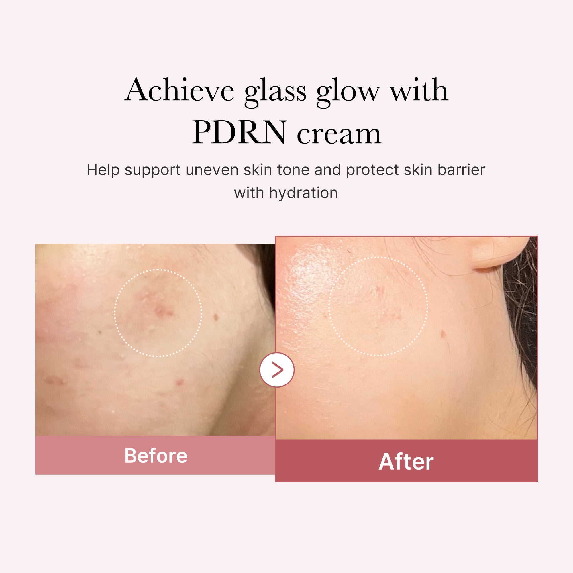 [Subscr.] PDRN Pink Peptide Cream - Medicube Bargain