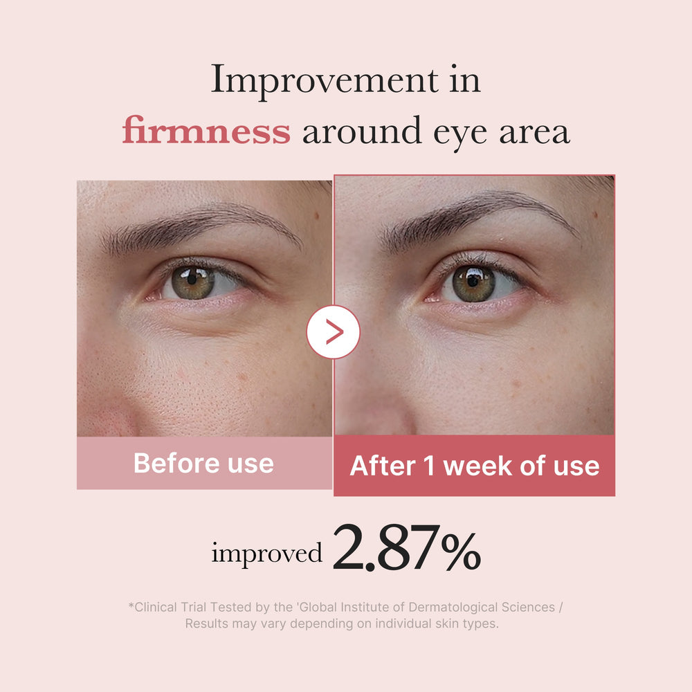 [Subscr.] PDRN Pink Peptide Eye Cream - Medicube Sale