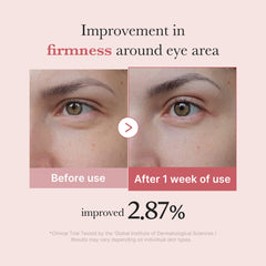 [Subscr.] PDRN Pink Peptide Eye Cream - Medicube Sale