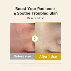Kojic Acid Turmeric Vitamin Gold Jelly Mist Serum - Medicube On Sale