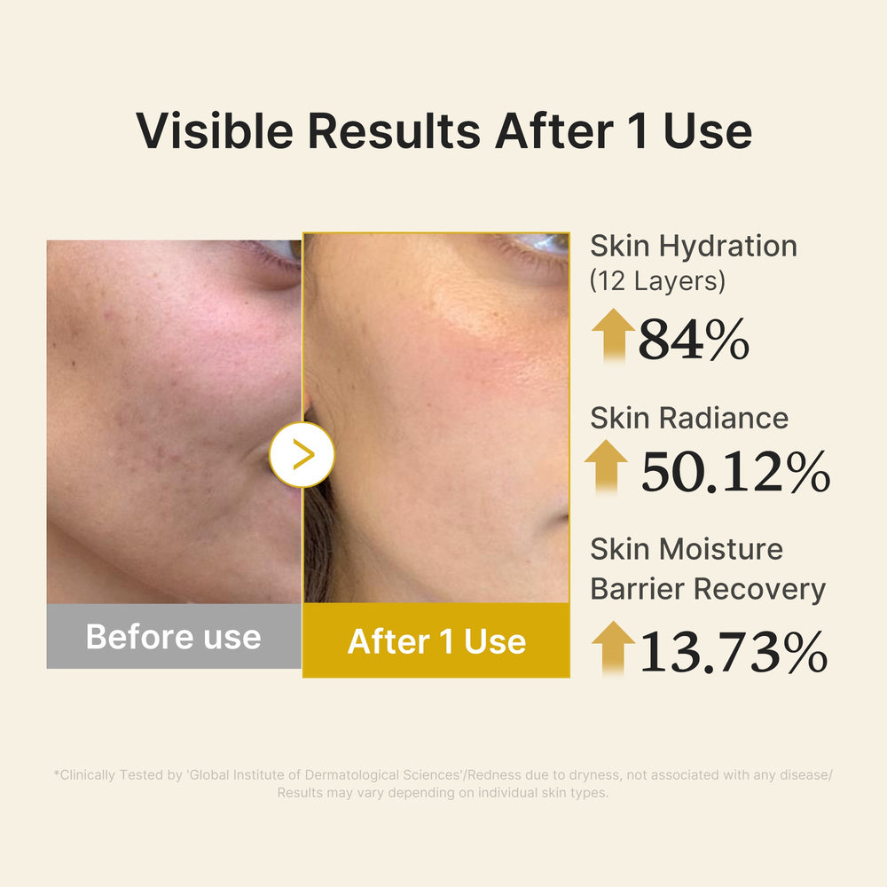 Kojic Acid Turmeric Vitamin Gold Jelly Mist Serum - Medicube On Sale