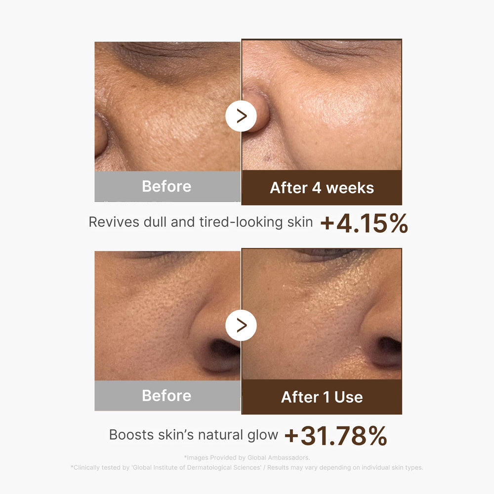 Deep Vitamin C Capsule Serum - Medicube Limited Offer