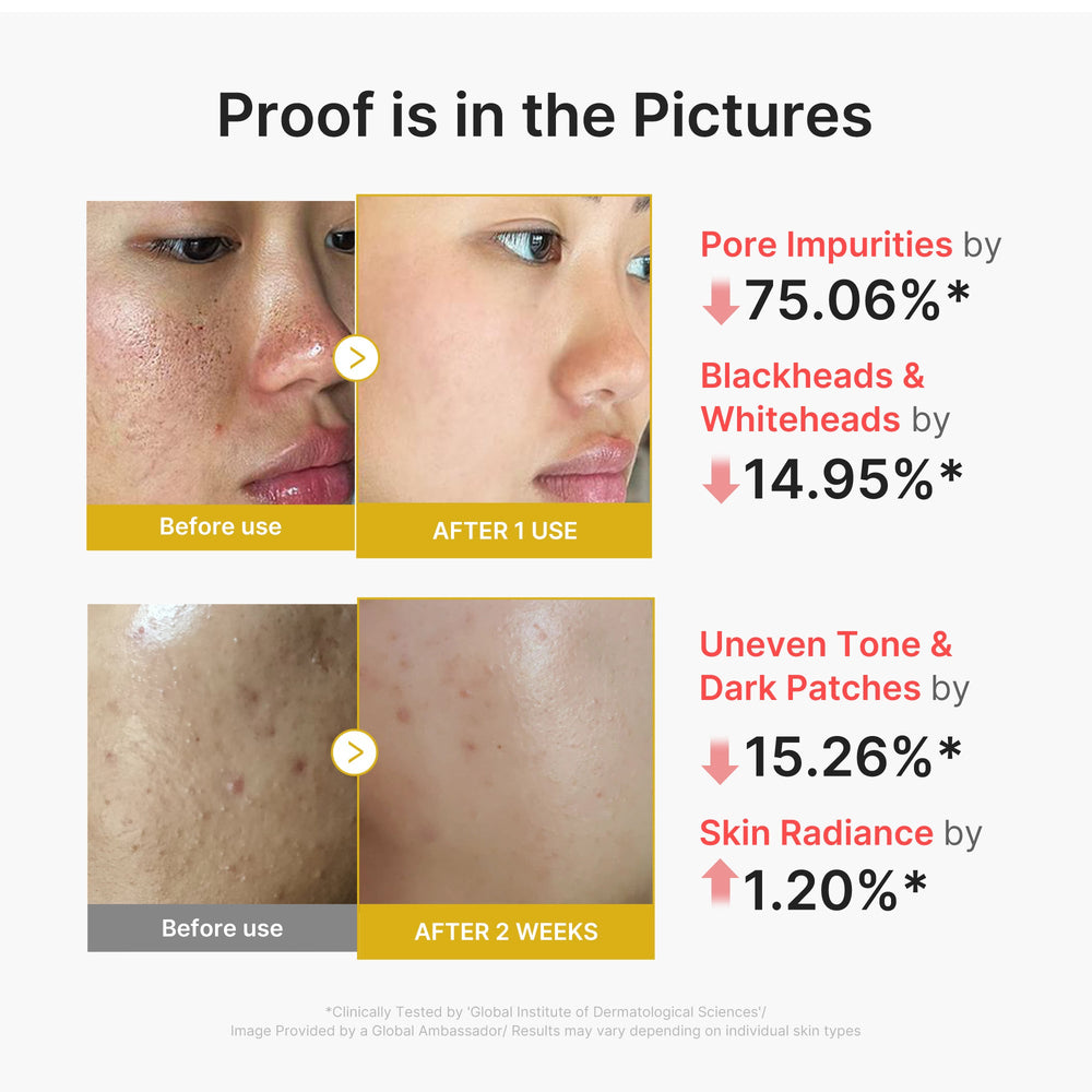 Kojic Acid Turmeric Peel Shot - Medicube Outlets