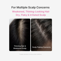 Rosemary PDRN Scalp Serum - Medicube Hot Deal