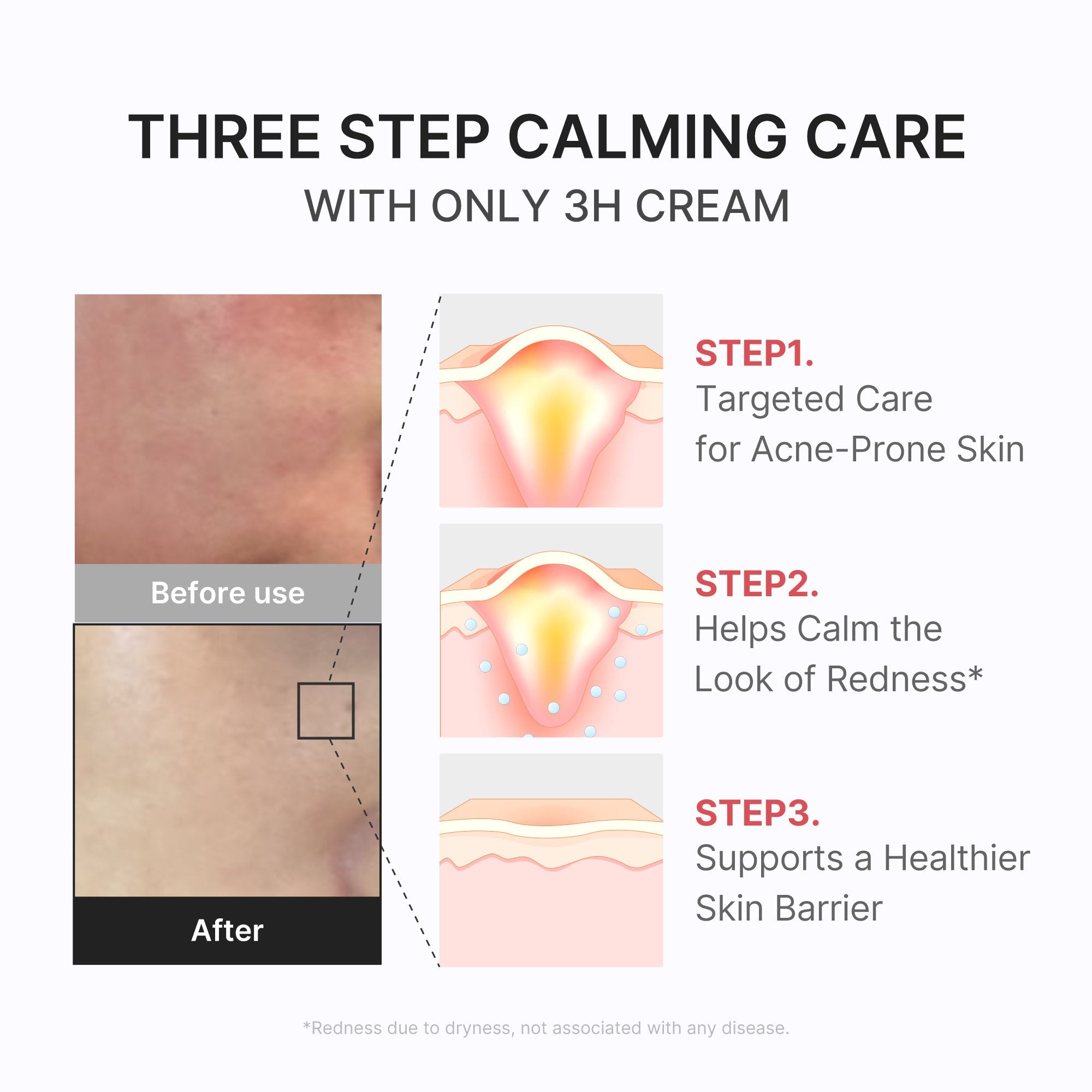 medicube 3H Daily Relief Cream | Daily Soothing Moisturizer for All - Medicube Hot Deal